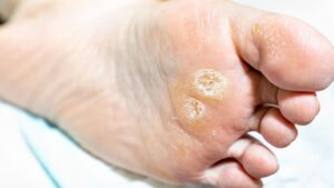 Foot Care For Seniors Toronto